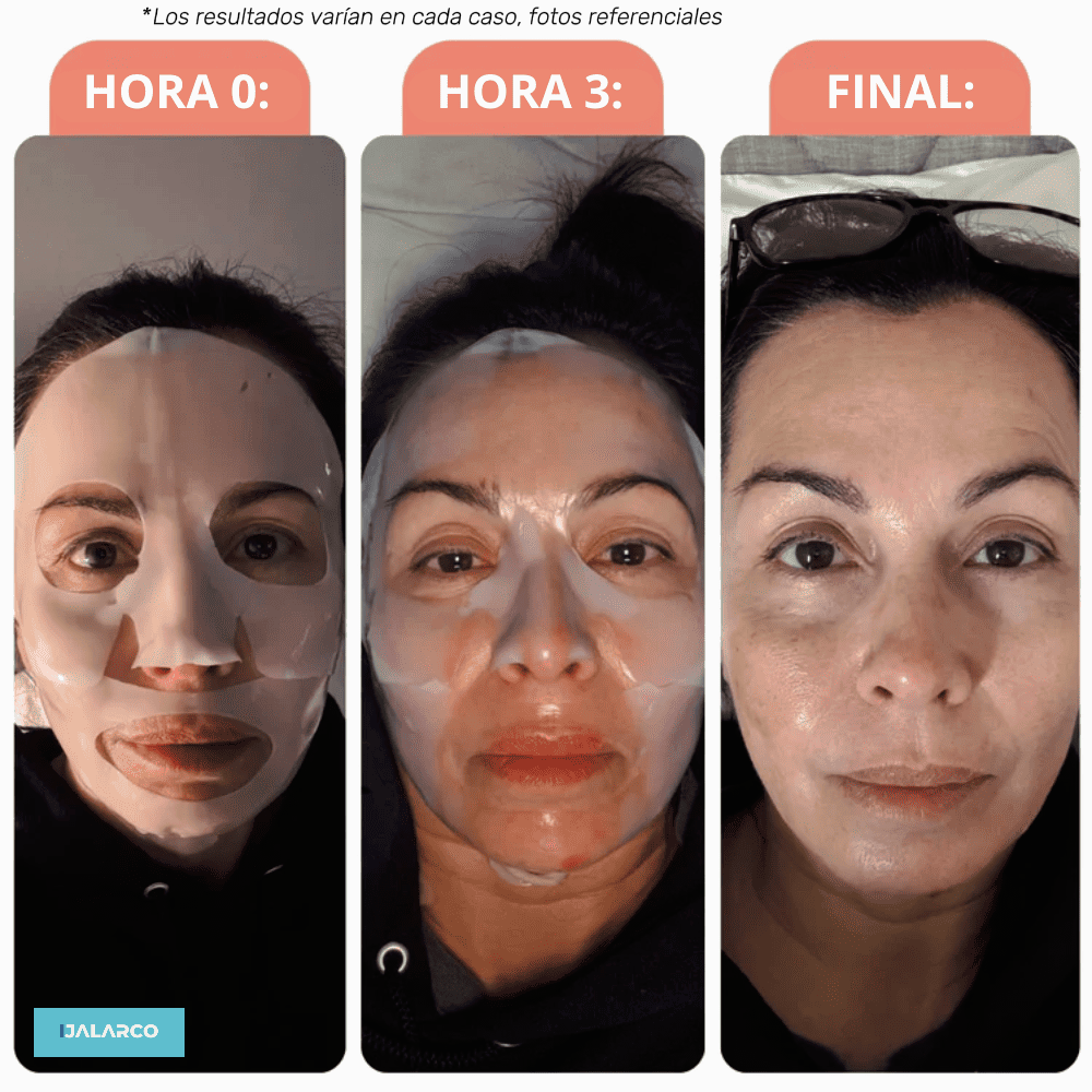 MASCARILLA DE COLÁGENO ROSTRO COMPLETO (5 UNIDADES)